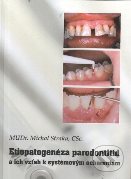 Kniha: Etiopatogenéza parodontitíd a ich vzťah k systémovým ochoreniam (Michal Straka). S Graf, 2014 Kniha: Etiopatogenéza parodontitíd a ich vzťah k systémovým ochoreniam (Michal Straka). S Graf, 2014