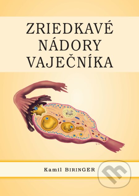 Kniha: Zriedkavé nádory vaječníka (Kamil Biringer). Vydavateľstvo P + M, 2022 Kniha: Zriedkavé nádory vaječníka (Kamil Biringer). Vydavateľstvo P + M, 2022