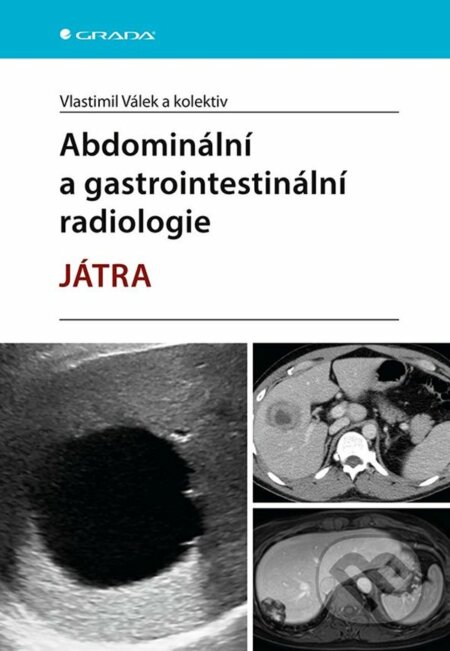 Kniha: Abdominální a gastrointestinální radiologie (Vlastimil Válek a kolektiv). Grada, 2023 Kniha: Abdominální a gastrointestinální radiologie (Vlastimil Válek a kolektiv). Grada, 2023