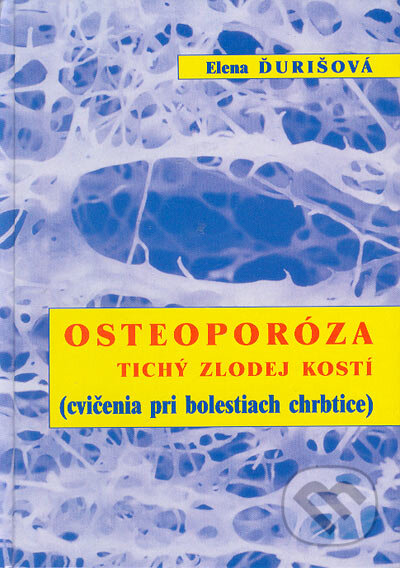 Kniha: Osteoporóza-tichý zlodej kostí (Elena Ďurišová). Elena Ďurišová-AKU-HOMEO, 2004 Kniha: Osteoporóza-tichý zlodej kostí (Elena Ďurišová). Elena Ďurišová-AKU-HOMEO, 2004