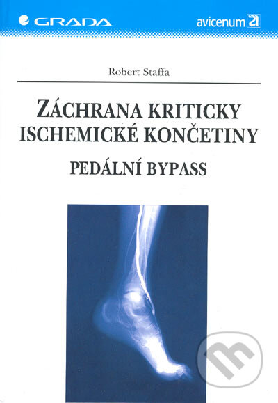 Kniha: Záchrana kriticky ischemické končetiny (Robert Staffa). Grada, 2005 Kniha: Záchrana kriticky ischemické končetiny (Robert Staffa). Grada, 2005