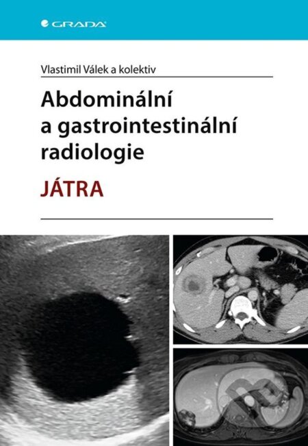 E-kniha: Abdominální a gastrointestinální radiologie (Vlastimil Válek a kolektív). Grada, 2023 E-kniha: Abdominální a gastrointestinální radiologie (Vlastimil Válek a kolektív). Grada, 2023