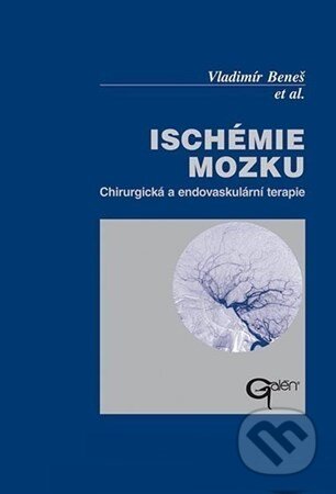 Kniha: Ischémie mozku (Vladimír Beneš a kolektív). Galén, 2003 Kniha: Ischémie mozku (Vladimír Beneš a kolektív). Galén, 2003