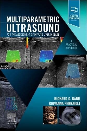Kniha: Multiparametric Ultrasound for the Assessment of Diffuse Liver Disease (Richard G. Barr a Giovanna Ferraioli). Elsevier Science, 2022 Kniha: Multiparametric Ultrasound for the Assessment of Diffuse Liver Disease (Richard G. Barr a Giovanna Ferraioli). Elsevier Science, 2022