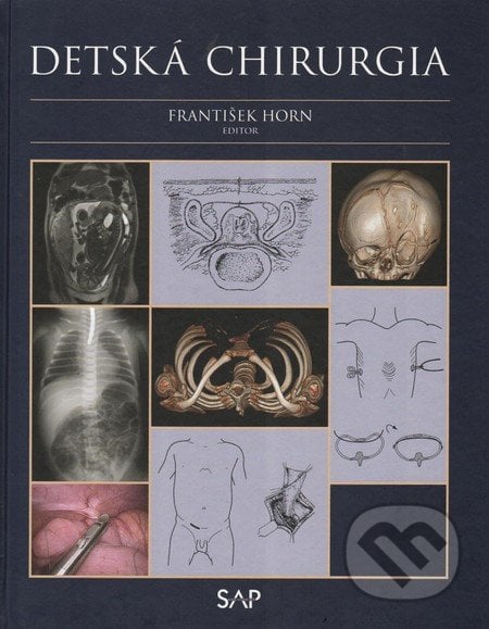 Detská chirurgia - František Horn, Slovak Academic Press, 2014