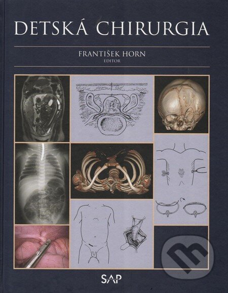 Kniha: Detská chirurgia (František Horn). Slovak Academic Press, 2014 Kniha: Detská chirurgia (František Horn). Slovak Academic Press, 2014