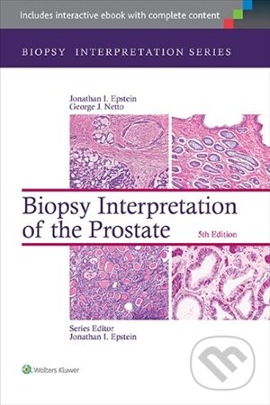 Kniha: Biopsy Interpretation of the Liver (Michael Torbenson). Lippincott Williams & Wilkins, 2014 Kniha: Biopsy Interpretation of the Liver (Michael Torbenson). Lippincott Williams & Wilkins, 2014