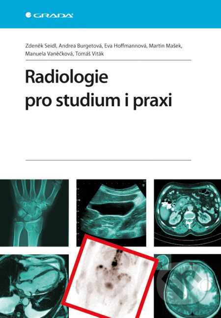 E-kniha: Radiologie pro studium i praxi (Autorský kolektiv a Zdeněk Seidl). Grada, 2012 E-kniha: Radiologie pro studium i praxi (Autorský kolektiv a Zdeněk Seidl). Grada, 2012