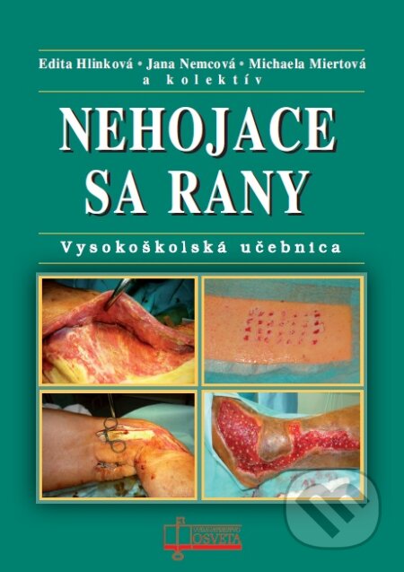 Kniha: Nehojace sa rany (Edita Hlinková, Jana Nemcová, Michaela Miertová a kolektív). Osveta, 2015 Kniha: Nehojace sa rany (Edita Hlinková, Jana Nemcová, Michaela Miertová a kolektív). Osveta, 2015