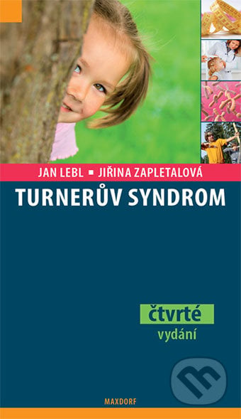 Turnerův syndrom - Jan Lebl, Jiřina Zapletalová, Maxdorf, 2015