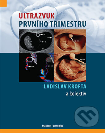 Kniha: Ultrazvuk prvního trimestru (Ladislav Krofta). Maxdorf, 2017 Kniha: Ultrazvuk prvního trimestru (Ladislav Krofta). Maxdorf, 2017