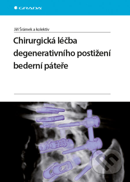 E-kniha: Chirurgická léčba degenerativního postižení bederní páteře (Jiří Donát). Grada, 2015 E-kniha: Chirurgická léčba degenerativního postižení bederní páteře (Jiří Donát). Grada, 2015
