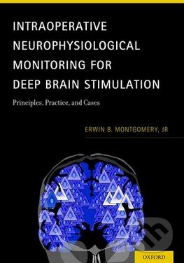 Kniha: Intraoperative Neurophysiological Monitoring for Deep Brain Stimulation (Erwin B. Montgomery). Oxford University Press, 2014 Kniha: Intraoperative Neurophysiological Monitoring for Deep Brain Stimulation (Erwin B. Montgomery). Oxford University Press, 2014