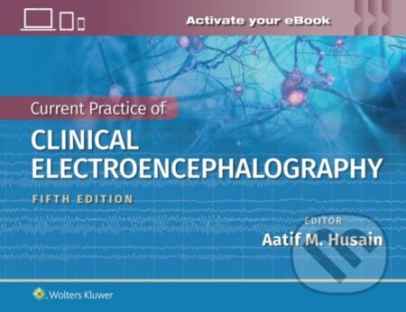 Kniha: Current Practice of Clinical Electroencephalography (Aatif M. Husain). Wolters Kluwer Health, 2023 Kniha: Current Practice of Clinical Electroencephalography (Aatif M. Husain). Wolters Kluwer Health, 2023