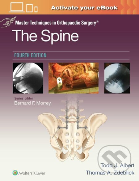 Kniha: Master Techniques in Orthopaedic Surgery: The Spine (Thomas A. Zdeblick a Todd Albert). Wolters Kluwer Health, 2023 Kniha: Master Techniques in Orthopaedic Surgery: The Spine (Thomas A. Zdeblick a Todd Albert). Wolters Kluwer Health, 2023