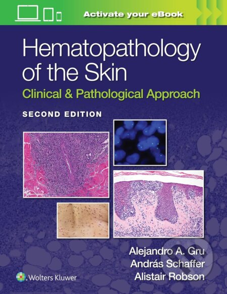 Kniha: Hematopathology of the Skin (Alejandro Ariel Gru, Alistair Robson a Andras Schaffer). Wolters Kluwer Health, 2023 Kniha: Hematopathology of the Skin (Alejandro Ariel Gru, Alistair Robson a Andras Schaffer). Wolters Kluwer Health, 2023