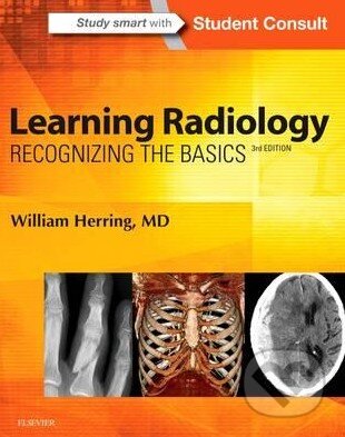 Kniha: Learning Radiology (William Herring). Saunders, 2015 Kniha: Learning Radiology (William Herring). Saunders, 2015