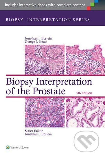 Biopsy Interpretation of the Prostate - Jonathan Epstein, Lippincott Williams & Wilkins, 2014