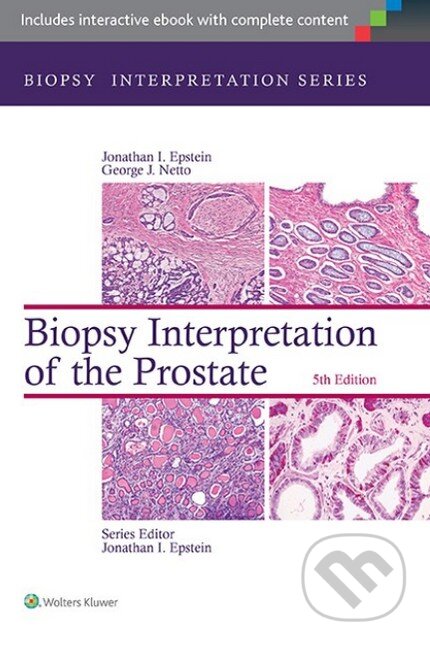 Kniha: Biopsy Interpretation of the Prostate (Jonathan Epstein). Lippincott Williams & Wilkins, 2014 Kniha: Biopsy Interpretation of the Prostate (Jonathan Epstein). Lippincott Williams & Wilkins, 2014