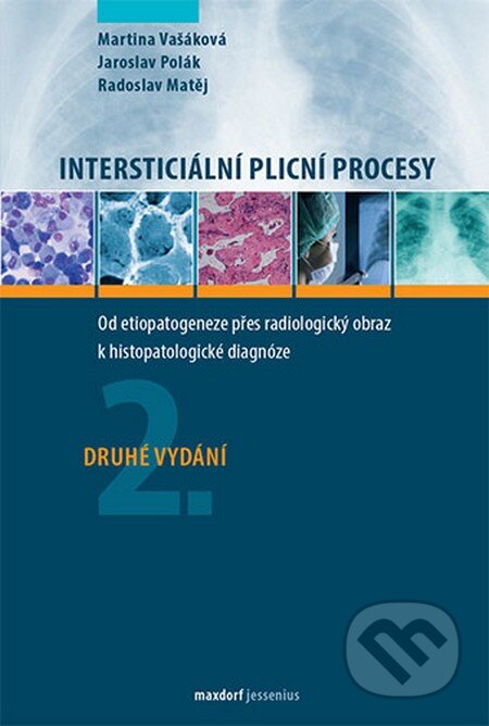Kniha: Intersticiální plicní procesy (Jaroslav Poláik a Martina Vašáková). Maxdorf, 2016 Kniha: Intersticiální plicní procesy (Jaroslav Poláik a Martina Vašáková). Maxdorf, 2016