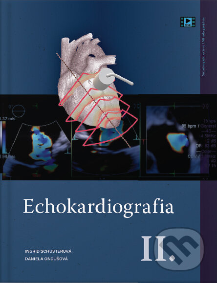 Kniha: Echokardiografia II. (Daniela Ondušová a Ingrid Schusterová). EQUILIBRIA, 2024 Kniha: Echokardiografia II. (Daniela Ondušová a Ingrid Schusterová). EQUILIBRIA, 2024