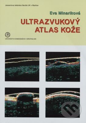 Kniha: Ultrazvukový atlas kože (Eva Mináriková). Univerzita Komenského Bratislava, 2017 Kniha: Ultrazvukový atlas kože (Eva Mináriková). Univerzita Komenského Bratislava, 2017