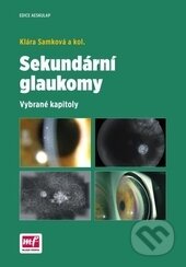 Kniha: Sekundární glaukomy (Klára Samková a kolektív). Mladá fronta, 2016 Kniha: Sekundární glaukomy (Klára Samková a kolektív). Mladá fronta, 2016