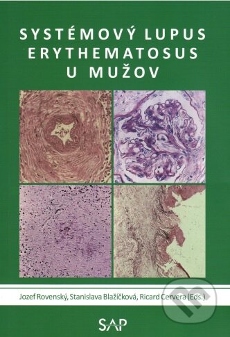 Kniha: Systemovy lupus erythematosus u muzov (Jozef Rovenský a Stanislava Blažičková). Slovak Academic Press, 2015 Kniha: Systemovy lupus erythematosus u muzov (Jozef Rovenský a Stanislava Blažičková). Slovak Academic Press, 2015