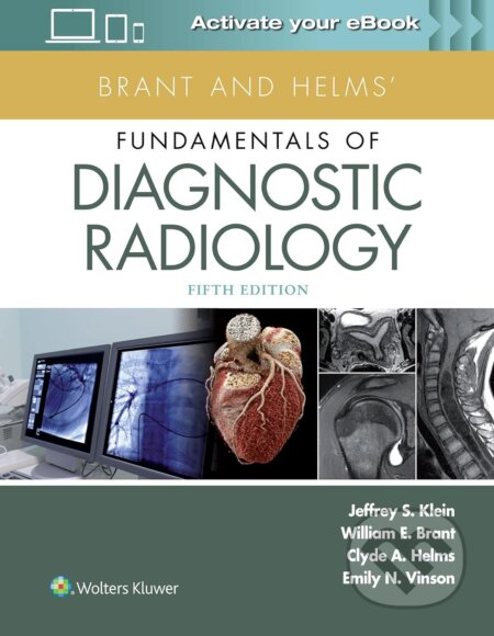 Kniha: Brant and Helms' Fundamentals of Diagnostic Radiology (Clyde A. Helms, Emily N. Vinson, Jeffrey Klein a William E. Brant). Lippincott Williams & Wilkins, 2018 Kniha: Brant and Helms' Fundamentals of Diagnostic Radiology (Clyde A. Helms, Emily N. Vinson, Jeffrey Klein a William E. Brant). Lippincott Williams & Wilkins, 2018
