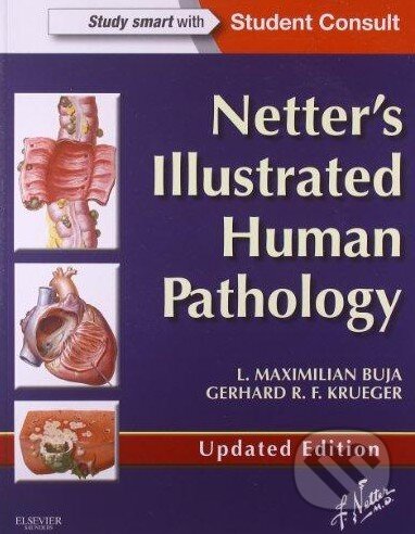 Kniha: Netter's Illustrated Human Pathology (Gerhard R.F. Krueger a L. Maximilian Buja). Saunders, 2013 Kniha: Netter's Illustrated Human Pathology (Gerhard R.F. Krueger a L. Maximilian Buja). Saunders, 2013