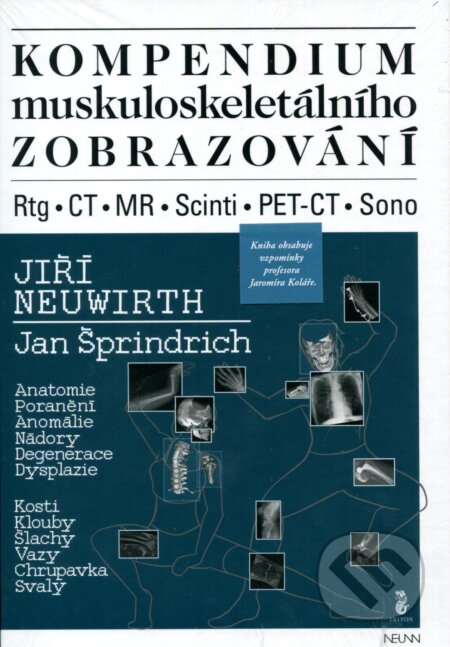 Kniha: Kompendium muskuloskeletálního zobrazování (Jan Šprindrich a Jiří Neuwirth). Triton, 2016 Kniha: Kompendium muskuloskeletálního zobrazování (Jan Šprindrich a Jiří Neuwirth). Triton, 2016