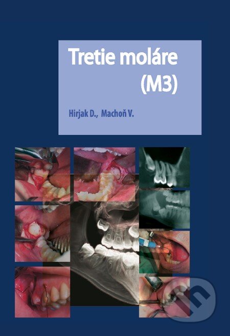 Kniha: Tretie moláre (M3) (Dušan Hirjak a Vladimír Machoň). Slovensk, 2016 Kniha: Tretie moláre (M3) (Dušan Hirjak a Vladimír Machoň). Slovensk, 2016