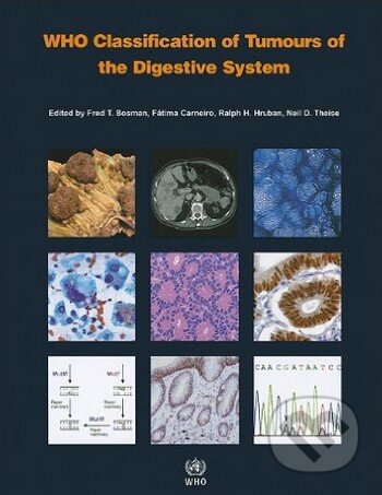 Kniha: WHO Classification of Tumours of the Digestive System (Fred T. Bosman a kolektív). World Health Organization, 2010 Kniha: WHO Classification of Tumours of the Digestive System (Fred T. Bosman a kolektív). World Health Organization, 2010
