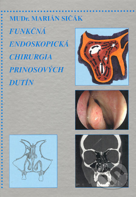 Kniha: Funkčná endoskopická chirurgia prinosových dutín (Marián Sičák). Osveta, 2001 Kniha: Funkčná endoskopická chirurgia prinosových dutín (Marián Sičák). Osveta, 2001