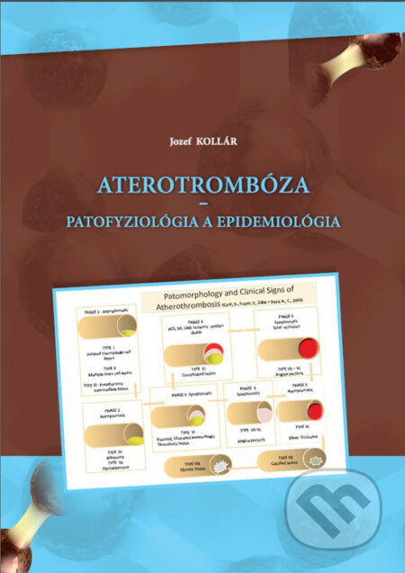 Kniha: Aterotrombóza (Jozef Kollár). EQUILIBRIA, 2016 Kniha: Aterotrombóza (Jozef Kollár). EQUILIBRIA, 2016
