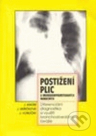 Kniha: Postižení plic u imunokompromitovaných nemocných (Jiří Mayer). Národní centrum ošetrovatelství, 1995 Kniha: Postižení plic u imunokompromitovaných nemocných (Jiří Mayer). Národní centrum ošetrovatelství, 1995