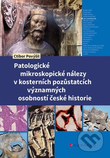 Patologické mikroskopické nálezy v kosterních pozůstatcích významných osobností české historie - Ctibor Povýšil, Grada, 2024