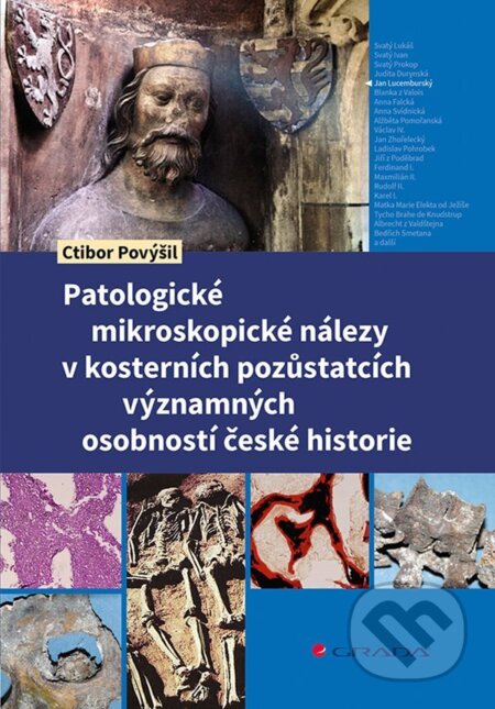 E-kniha: Patologické mikroskopické nálezy v kosterních pozůstatcích významných osobností české historie (Ctibor Povýšil). Grada, 2024 E-kniha: Patologické mikroskopické nálezy v kosterních pozůstatcích významných osobností české historie (Ctibor Povýšil). Grada, 2024