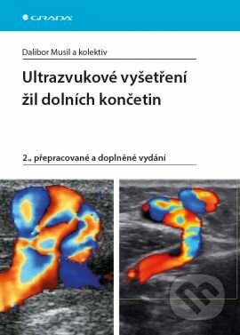 Kniha: Ultrazvukové vyšetření žil dolních končetin (Dalibor Musil a kolektiv). Grada, 2016 Kniha: Ultrazvukové vyšetření žil dolních končetin (Dalibor Musil a kolektiv). Grada, 2016
