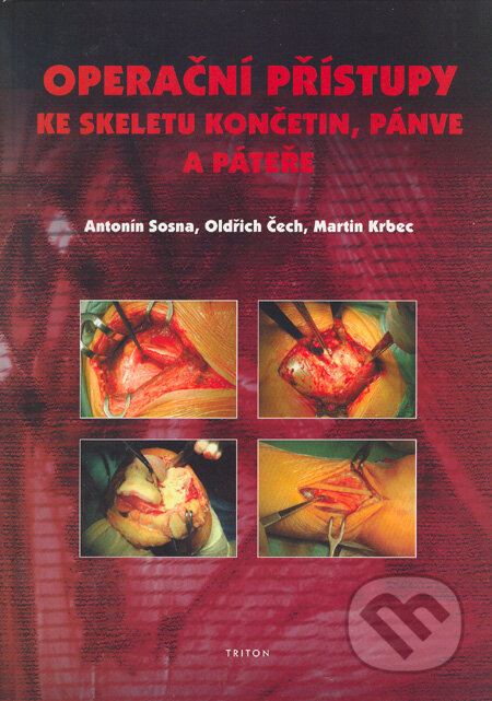 Kniha: Operační přístupy ke skeletu končetin, pánve a páteře (Antonín Sosna, Martin Krbec a Oldřich Čech). Triton, 2005 Kniha: Operační přístupy ke skeletu končetin, pánve a páteře (Antonín Sosna, Martin Krbec a Oldřich Čech). Triton, 2005
