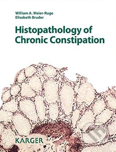 Kniha: Histopathology of Chronic Constipation (Elisabeth Bruder a kolektiv). Karger, 2012 Kniha: Histopathology of Chronic Constipation (Elisabeth Bruder a kolektiv). Karger, 2012