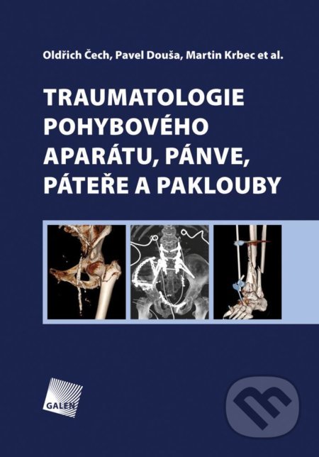 Kniha: Traumatologie pohybového aparátu, pánve, páteře a paklouby (Martin Krbec a Oldřich Čech). Galén, 2016 Kniha: Traumatologie pohybového aparátu, pánve, páteře a paklouby (Martin Krbec a Oldřich Čech). Galén, 2016