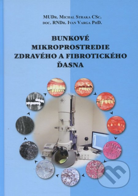 Kniha: Bunkové mikroprostredie zdravého a fibrotického ďasna (Michal Straka). S Graf, 2016 Kniha: Bunkové mikroprostredie zdravého a fibrotického ďasna (Michal Straka). S Graf, 2016