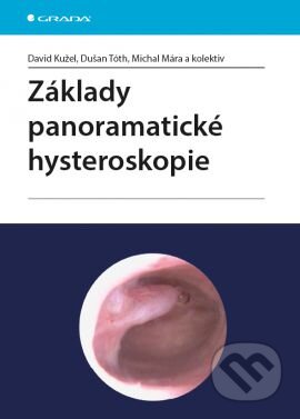 Kniha: Základy panoramatické hysteroskopie (David Kužel, Dušan Tóth, Michal Mára a kolektív). Grada, 2016 Kniha: Základy panoramatické hysteroskopie (David Kužel, Dušan Tóth, Michal Mára a kolektív). Grada, 2016