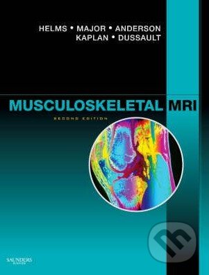 Kniha: Musculoskeletal MRI (Clyde A. Helms a kolektív). Saunders, 2008 Kniha: Musculoskeletal MRI (Clyde A. Helms a kolektív). Saunders, 2008