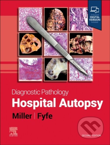 Kniha: Diagnostic Pathology: Hospital Autopsy (Billie S. Fyfe a Dylan V. Miller). Churchill Livingstone, 2024 Kniha: Diagnostic Pathology: Hospital Autopsy (Billie S. Fyfe a Dylan V. Miller). Churchill Livingstone, 2024