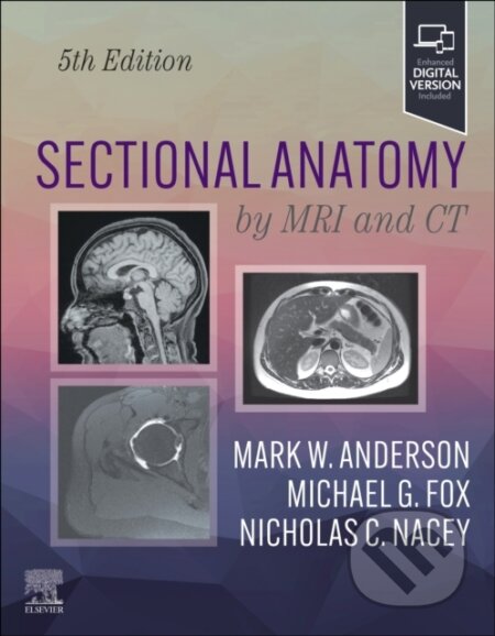 Kniha: Sectional Anatomy by MRI and CT (Mark W. Anderson, Michael G Fox a Nicholas C. Nacey). Elsevier Science, 2024 Kniha: Sectional Anatomy by MRI and CT (Mark W. Anderson, Michael G Fox a Nicholas C. Nacey). Elsevier Science, 2024
