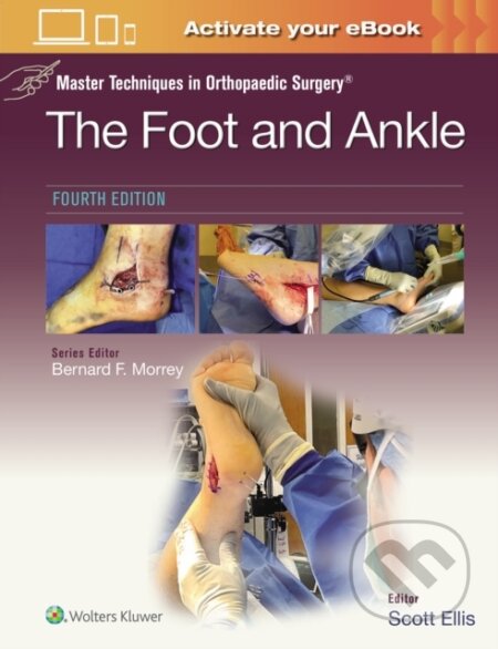 Kniha: Master Techniques in Orthopaedic Surgery: The Foot and Ankle (Scott Ellis). Wolters Kluwer Health, 2024 Kniha: Master Techniques in Orthopaedic Surgery: The Foot and Ankle (Scott Ellis). Wolters Kluwer Health, 2024