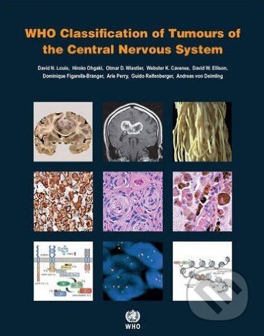 Kniha: WHO Classification of Tumours of the Central Nervous System (Autorský kolektív). World Health Organization, 2016 Kniha: WHO Classification of Tumours of the Central Nervous System (Autorský kolektív). World Health Organization, 2016