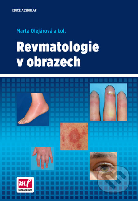 Kniha: Revmatologie v obrazech (Marta Olejárová). Mladá fronta, 2016 Kniha: Revmatologie v obrazech (Marta Olejárová). Mladá fronta, 2016